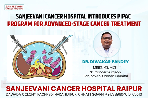 Sanjeevani Cancer Hospital Introduces PIPAC Program for Advanced-Stage Cancer Treatment