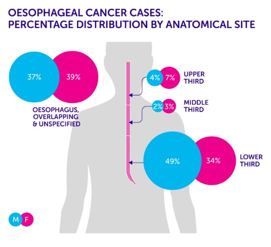 OESOPHAGAL CANCER