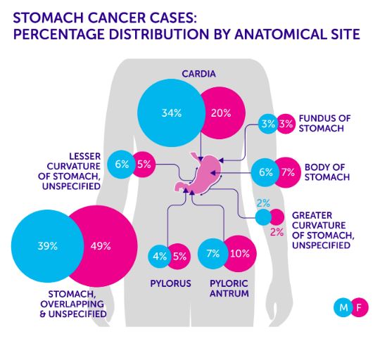 STOMACH CANCER